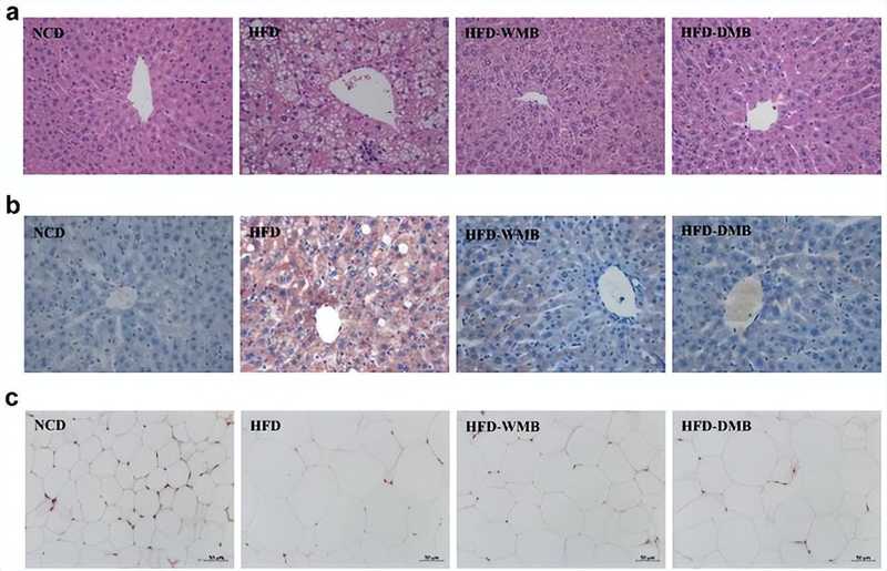  别让“吃绿豆”变成无用功：肝脏健康的真相藏在肠道里 健康养生